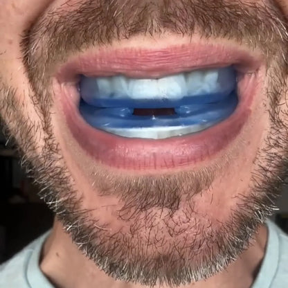 Honex™ Anti-Snoring Mouth Guard
